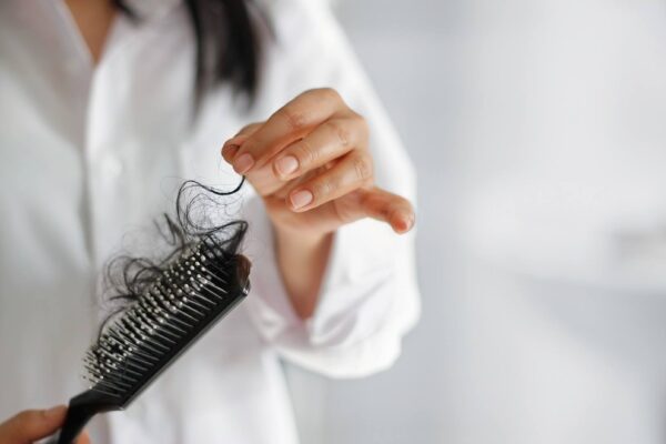 non-surgical hair loss treatment New Jersey